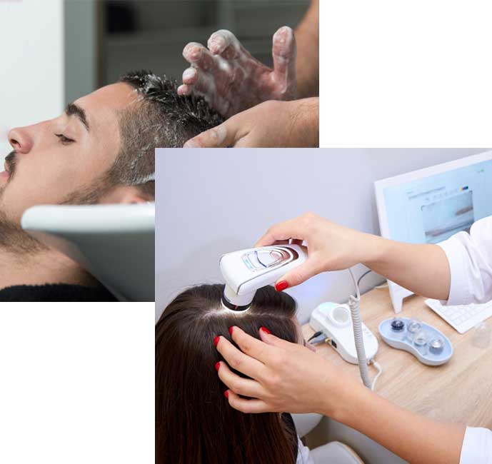 hair restoration replacement men women scranton exeter pa