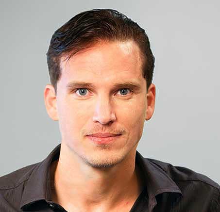 mens non-surgical hair replacement results scranton exeter pa