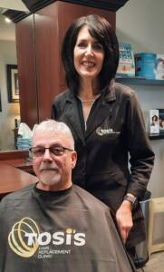 Men's completed hair restoration