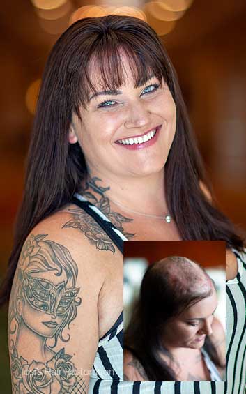 womens-thinning-hair-solution-exeter-pa Women's Hair Restoration - scranton pennsylvania