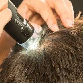 Hair Loss Rejuvenation Treatment Products - Scranton, Pennsylvania
