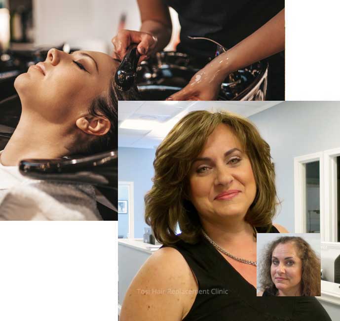 Scranton Exeter Womens hair loss replacement solutions pennsylvania